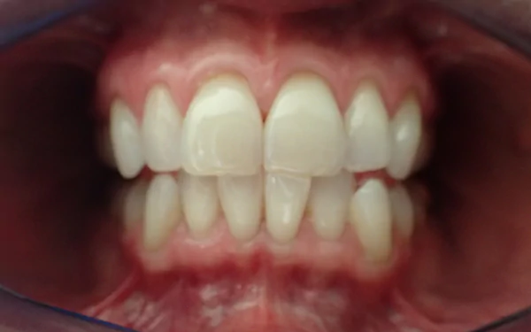 photography teeth HD Desktop Wallpaper | Background Image